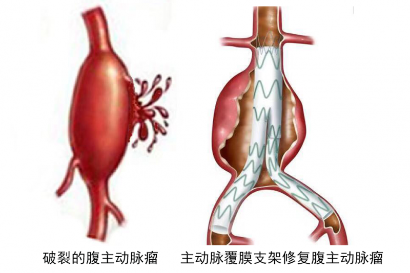 1564446288404188.png 两个图合成.png