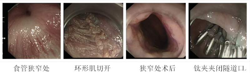 1618969944124142.png poem图片.png