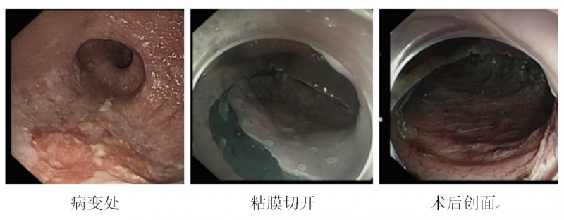 1618969951805267.png ESD图片.png
