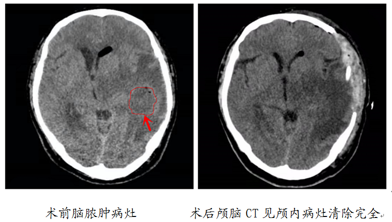 1619330912675824.png 微信截图_20210423110718.png