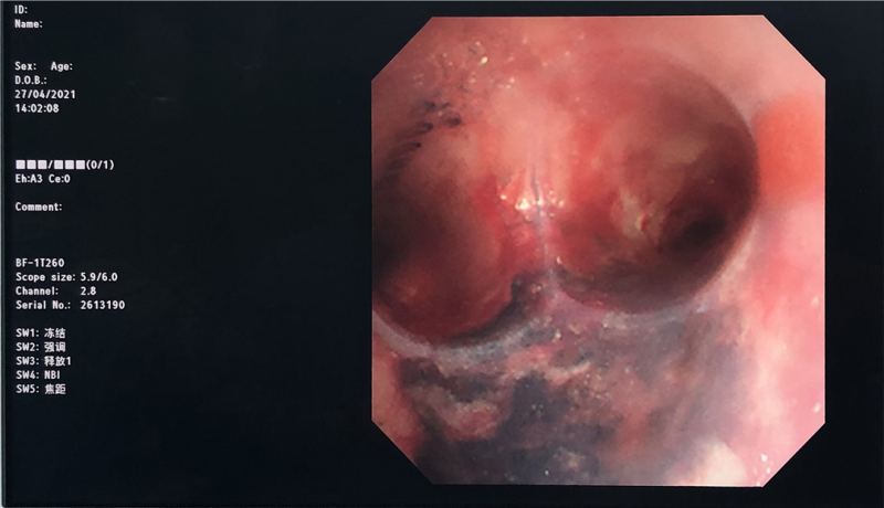 1620973271733563.png image.png