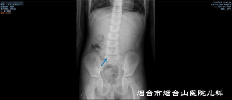 1642125122857892.png 2022011214210328537163925okkkkkkkkkkkkkkkkkkkkkkkkkkkkkkk_副本.png