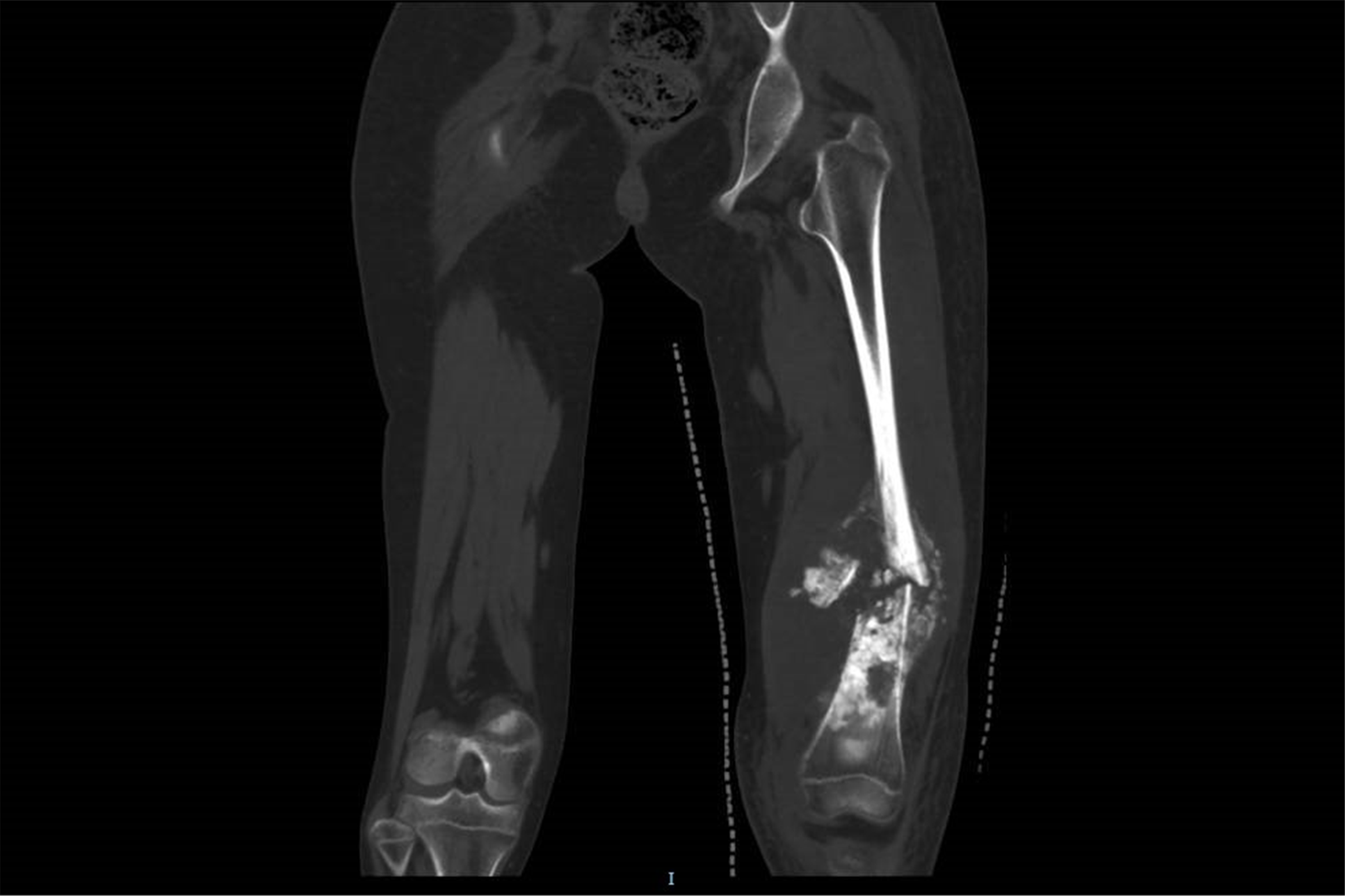 1776306886985129.png 2026041412484217269932371.png