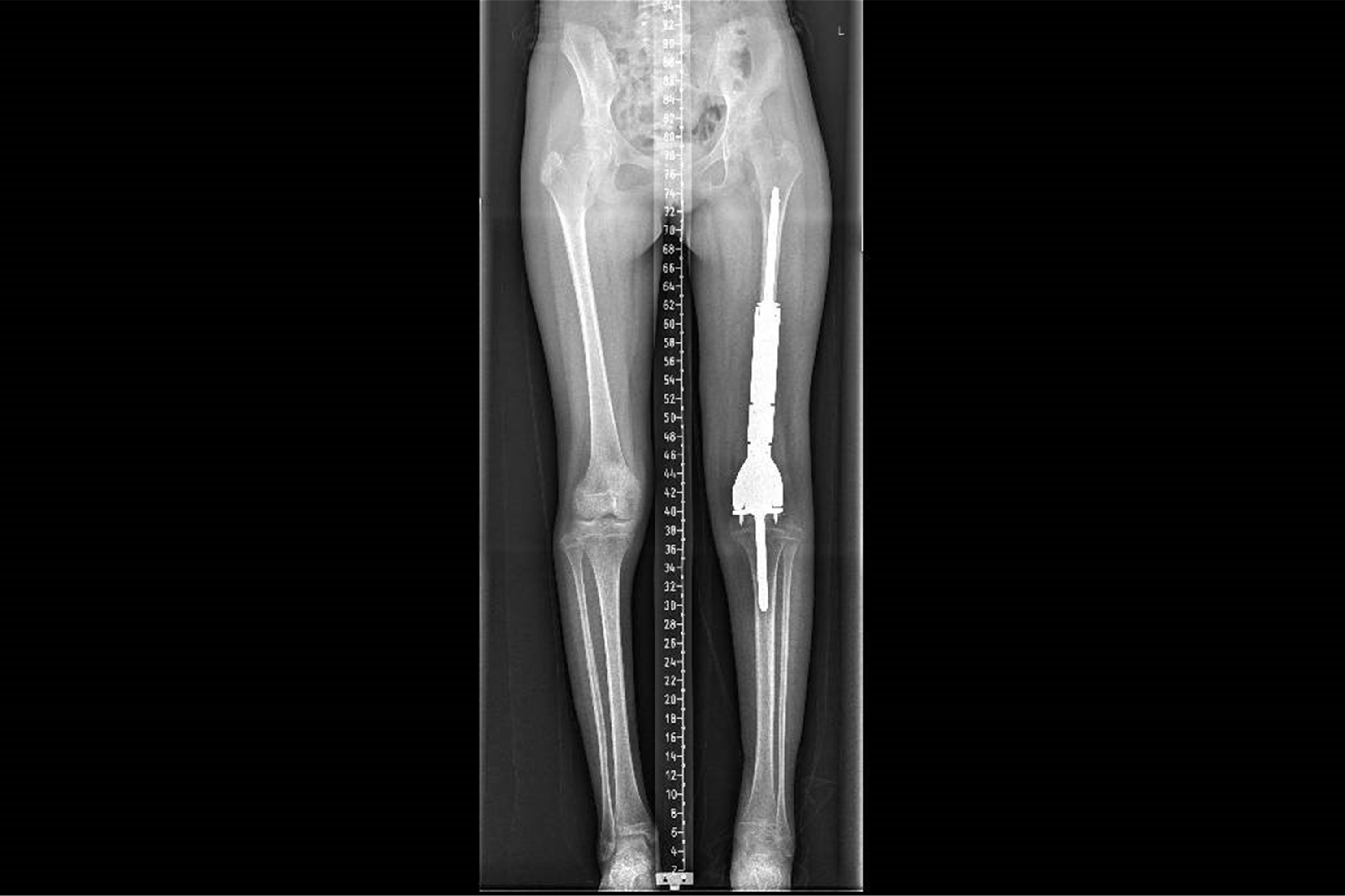 1776306950187165.png 2026041412490527745240802.png